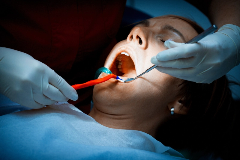Dental Fillings
