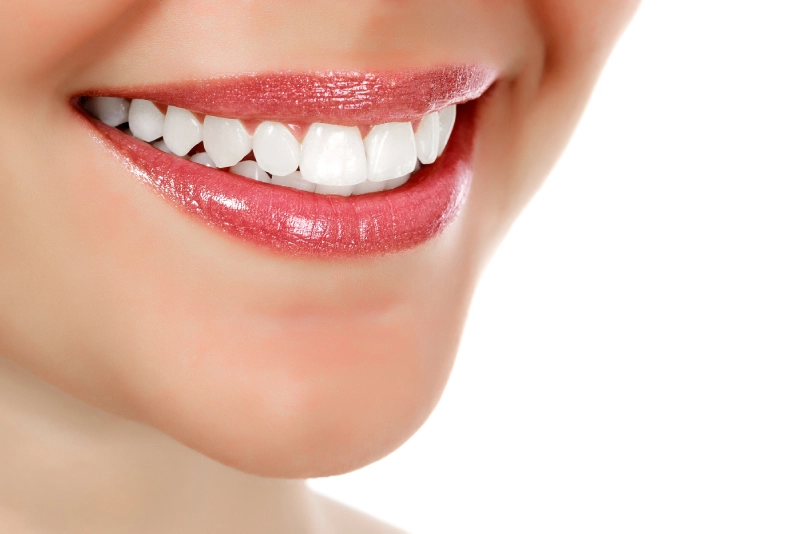 Teeth Whitening