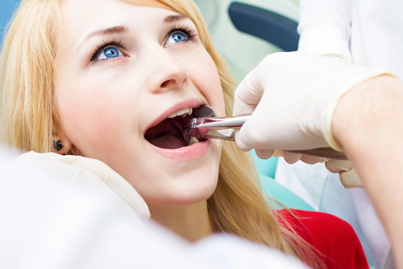 Tooth Extraction